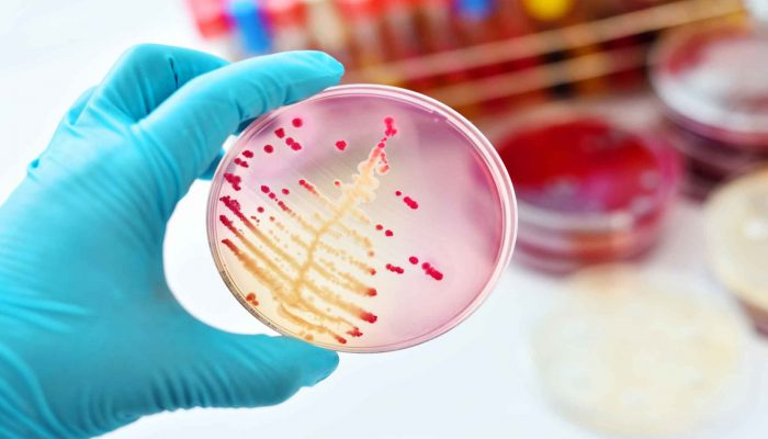 PREXELENT Unwanted harmful microbes Prexelent technology Premix